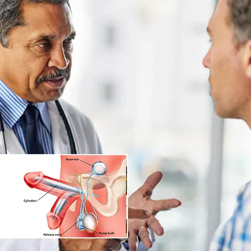 The Groundbreaking Techniques Behind Biocompatible Penile Implants
